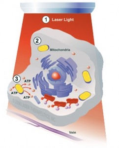 Low-Level_Laser-therapy