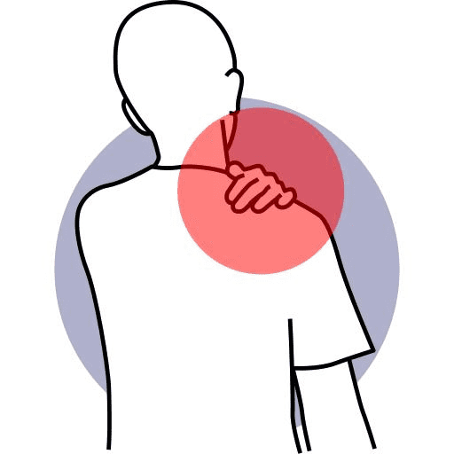 Bursitis