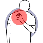 Osteoarthritis