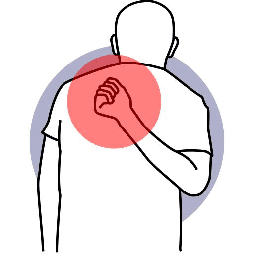 Osteoarthritis