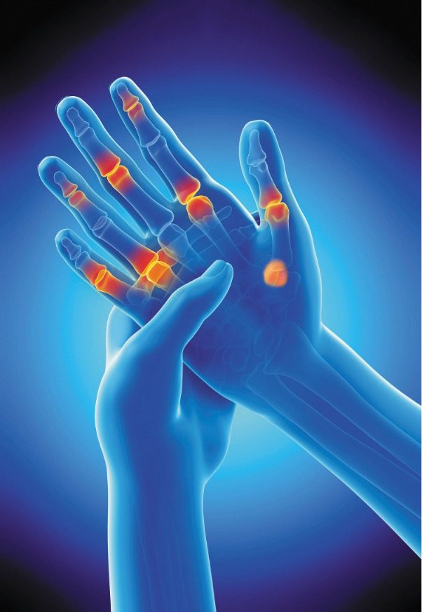 Hand Pain