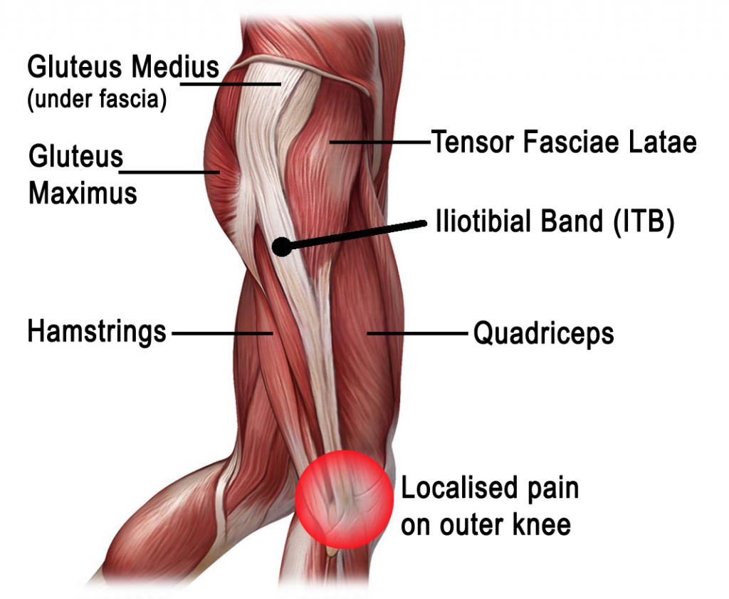 KneePain