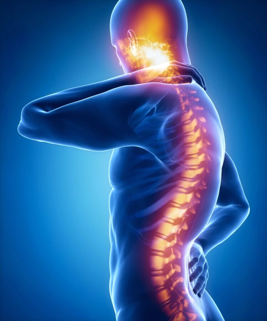 Nerve Pain