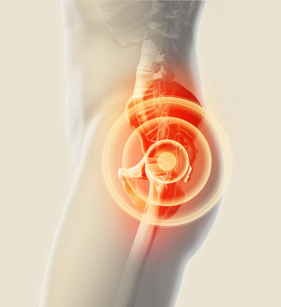 3d,Illustration,,Hip,Painful,Skeleton,X-ray,,Medical,Concept.