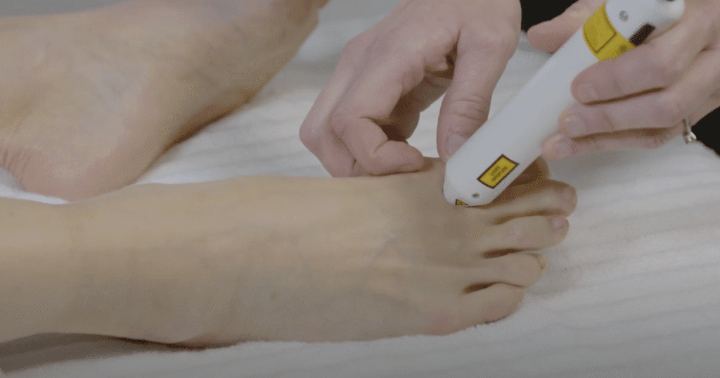 toe