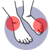 Stress Fractures & Undisplaced Fractures